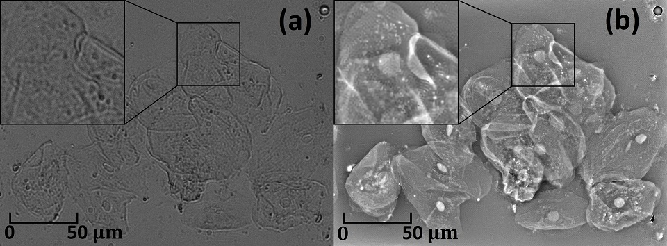 Cheek epithelial cells – the same sample. Left: close-up with limited resolution. Right: close-up under a microscope with algorithmically increased capacity. Photos from a computational microscope utilizing the method of Fourier ptychography.