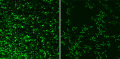 A photo from a confocal microscope; it displays a photosensitiser entering a microorganism.