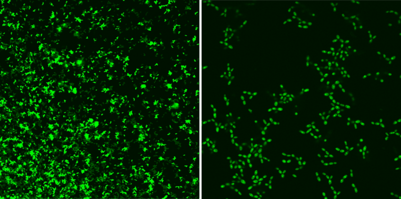 A photo from a confocal microscope; it displays a photosensitiser entering a microorganism.